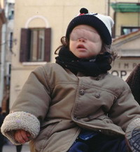 Tra i due litiganti il bimbo soffre