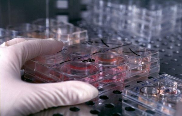 Dibattito sulle staminali: <br>terapia, speranza o illusione?